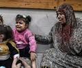 الطفل زيادة.. ضحية حرب يأمل بالعلاج خارج غزة