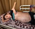 السرطان حوّل أيامها إلى معركة مفتوحة مع الألم والموت