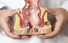 صورة توضيحية