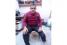 باسم نعيم الفحّام (35 عامًا) بترت ساقه حلال حرب الإبادة على غزة