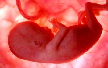 السائل الموجود حول الجنين هو سائل معقم وشفاف