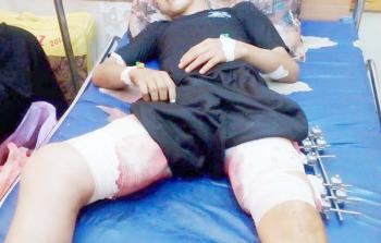 الجريح / يوسف القطراوي 