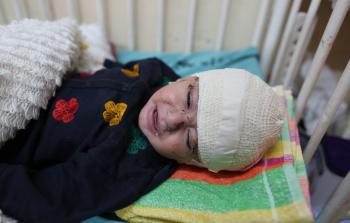 الرضيع يوسف أبو شكيان (تصوير / محمود أبو حصيرة )