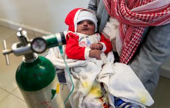 طفل يمني (أ ف ب)