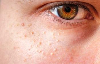 صحة الجهاز الهضمي تترك تأثيرها الواضح على الجلد