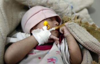 الكوليرا تحصد أرواح الأطفال اليمنيين (أ ف ب)