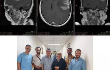 صورة مقطعية للمريض وطاقم الجراحة