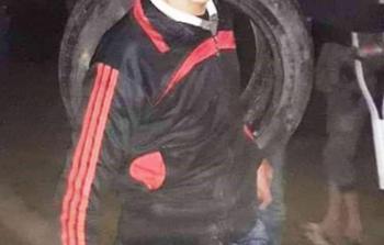 الطفل أبو زيد أصيب برصاصة في الرأس أطلقها عليه الاحتلال