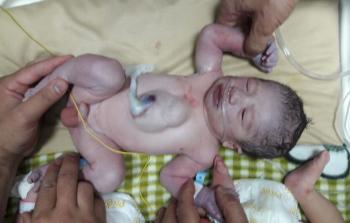 صورة الطفل الشهيد مصعب العرعير