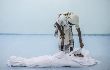 لقي كثيرون حتفهم في اليمن بسبب المرض والجوع (غيتي)