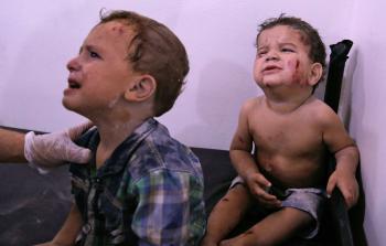 أطفال مصابون في غارة قرب دمشق (أ ف ب)