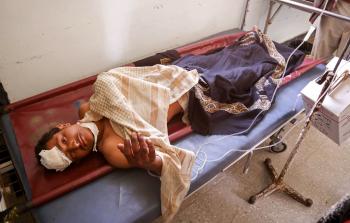 جريح يمني (أ ف ب)