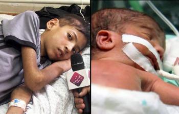 الرضيع خاص (يميناً) والطفل راضي (يساراً) (أرشيف)