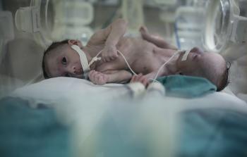 فرح وحنين (الأناضول)