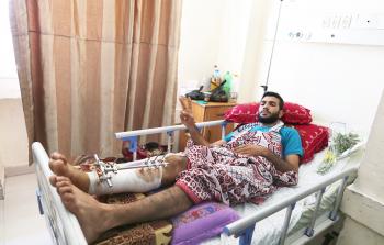 أحد الجرحى يتلقى العلاج بمستشفى الشفاء (تصوير / رمضان الأغا)