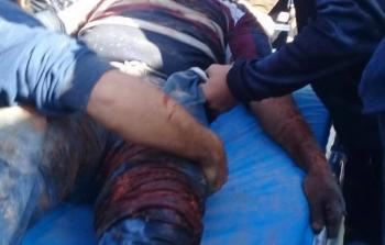 نقل الإصابات (فيس بوك)