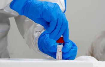 إجراءات احترازية لمنع تفشي 