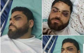 الأسير محمد السلايمة عقب إصابته برصاص الاحتلال