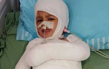 الطفل أحمد دوابشة الناجي الوحيد من عائلته (أرشيف)