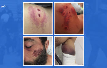 عناصر من الأجهزة الأمنية تعتدي بالضرب المُبرح على شاب من بيت لقيا (شبكة قدس)