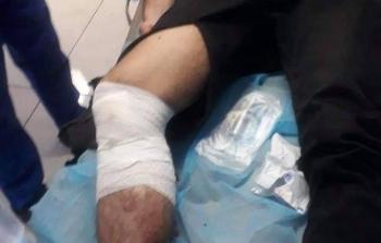 إصابات برصاص أمن السلطة