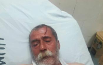 الصياد المصاب