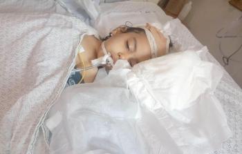 الطفلة البلبيسي المصابة برصاصة مجهولة المصدر