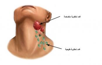 صورة تعبيرية