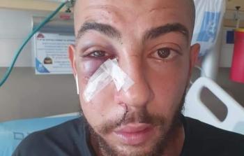 الشاب المقدسي المعتدى عليه