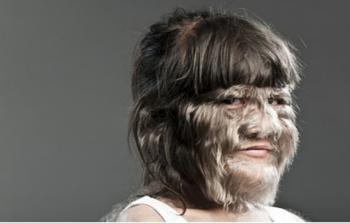 كارثة تحل بـ20 طفلًا بسبب منحهم دواءً خطأً