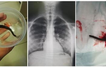 صور نشرها مجمع فلسطين الطبي عبر فيس بوك