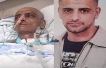 الأسير مسالمة قبل وبعد إصابته بالسرطان