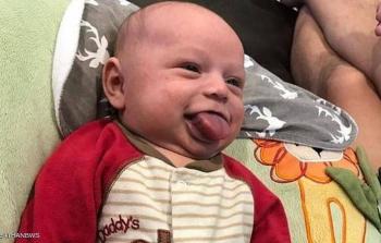 الطفل أوين بلسان أكبر من الطبيعي