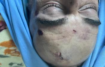 جثة المعارض نزار بنات