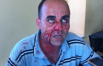 صورة أرشيفية لاعتداء سابق على الناشط نزار بنات