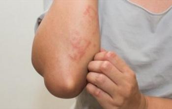 صورة تعبيرية