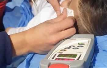 طفل مقدسي أصيب في وجهه بقنبلة صوت مساء اليوم