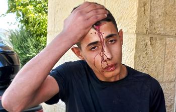 الفتى المصاب قرب مقبرة مأمن الله في مدينة القدس