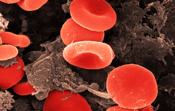 صورة توضيحية