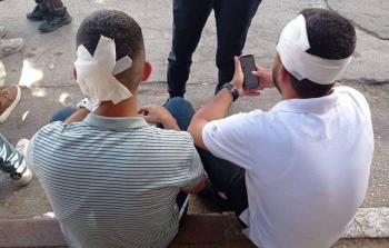 طلبة مصابون من اعتداء بلطجية السلطة في جامعة النجاح