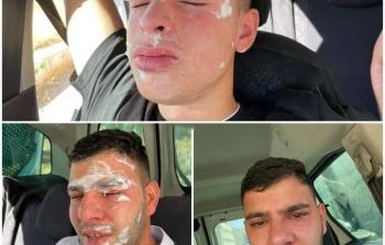 إصابات بين مستقبلي القيادي النتشة في الخليل أمس