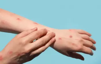 صورة تعبيرية
