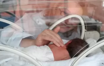 عليكم بلمس الخدج.. توصية من الصحة العالمية تقلب المفاهيم