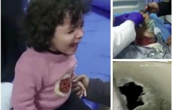 6 إصابات بينها أطفال في هجوم للمستوطنين على حوارة