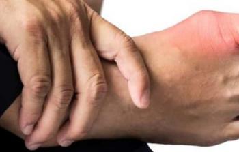 مرض النقرس