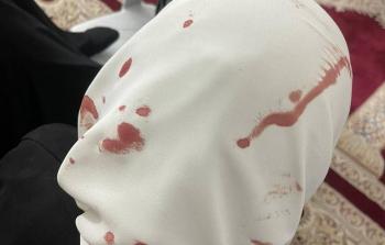 اعتقالات وإصابات بين صفوف المرابطين عقب اقتحام الاحتلال للمصلى القبلي