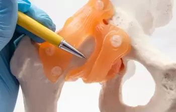 علماء يطورون طلاء لزراعة العظام.. مستوحى من أجنحة الحشرات