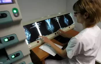 اختبارات على علاج لسرطان الثدي في مراحله المبكرة