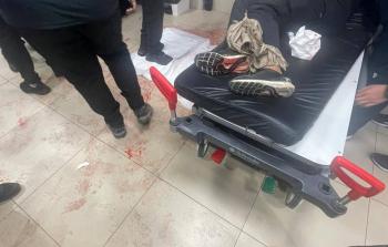 إصابات إثر قمع أجهزة السلطة جنازة شاب قتل بإطلاق نار في جنين