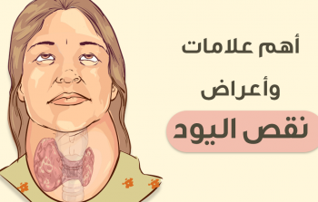 نقص اليود أبرز أسبابه.. ماذا تعرف عن تضخم الغدة الدرقية؟